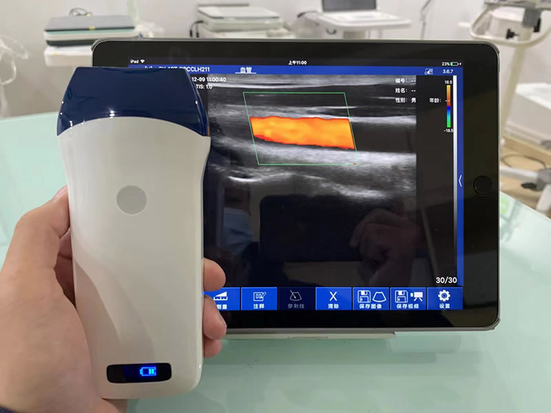 128 Elements 7.510MHz Linear Probe Handheld BW Ultrasound Scanner　